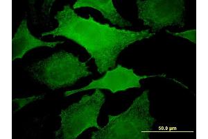 Immunofluorescence of monoclonal antibody to MAP3K13 on HeLa cell. (MAP3K13 抗体  (AA 711-810))