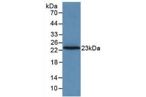 Western blot analysis of recombinant Rat F2. (Prothrombin 抗体  (AA 44-200))
