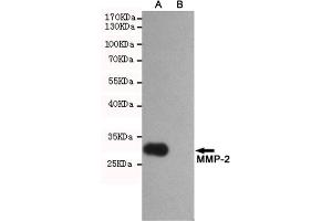 Western blot analysis of extracts from CHO-K1 (B) and CHO-K1 transfected by P-2 fragment(A) cell lysates using P-2 mouse mAb (1:2000 diluted). (MMP2 抗体)