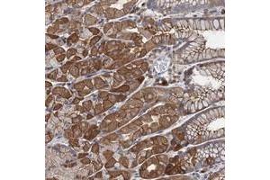Immunohistochemical staining of human stomach with LRCH4 polyclonal antibody  shows strong cytoplasmic and membranous positivity in glandular cells. (LRCH4 抗体)