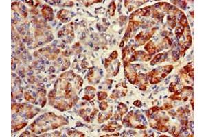 Immunohistochemistry of paraffin-embedded human pancreatic tissue using ABIN7151134 at dilution of 1:100 (RNF126 抗体  (AA 39-225))