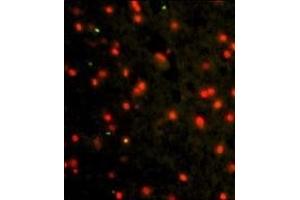 Immunofluorescence analysis of CDH4 Antibody (N-term) Antibody with paraffin-embedded human brain tissue. (Cadherin 4 抗体  (N-Term))
