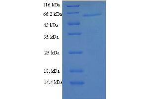 SDS-PAGE (SDS) image for Galectin 6 (GAL6) (AA 1-301), (full length) protein (GST tag) (ABIN5709847) (Galectin 6 Protein (GAL6) (AA 1-301, full length) (GST tag))
