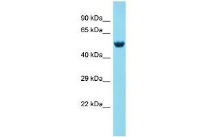 Host: Rabbit Target Name: MEX3A Sample Type: Fetal Brain lysates Antibody Dilution: 1. (MEX3A 抗体  (N-Term))
