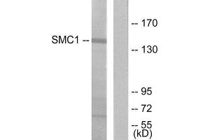 Western Blotting (WB) image for anti-Structural Maintenance of Chromosomes 1A (SMC1A) (Ser957) antibody (ABIN1848149) (SMC1A 抗体  (Ser957))