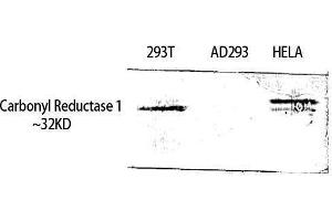 Western Blotting (WB) image for anti-Carbonyl Reductase 1 (CBR1) (Internal Region) antibody (ABIN3183645) (CBR1 抗体  (Internal Region))