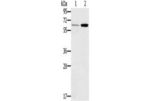 Western Blotting (WB) image for anti-Tumor Necrosis Factor Receptor Superfamily, Member 11a, NFKB Activator (TNFRSF11A) antibody (ABIN2435277) (TNFRSF11A 抗体)