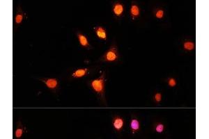 Immunofluorescence analysis of U-2 OS cells using KAT2A Polyclonal Antibody at dilution of 1:100 (40x lens). (KAT2A 抗体)