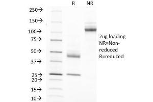 SDS-PAGE Analysis Purified MUC-1 Mouse Monoclonal Antibody (MUC1/845). (MUC1 抗体)