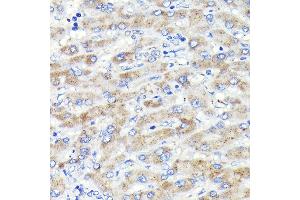 Immunohistochemistry of paraffin-embedded human liver using Glucosylceramidase beta (Glucosylceramidase beta (GBA)) Rabbit mAb (ABIN7267407) at dilution of 1:100 (40x lens). (GBA 抗体)