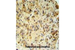 Immunohistochemistry (IHC) image for anti-Fucosidase, alpha-L- 1, Tissue (FUCA1) antibody (ABIN3002802) (FUCA1 抗体)