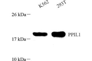 Western blot analysis of PPIL1 (ABIN7075004),at dilution of 1: 800 (PPIL1 抗体)
