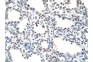 CSDC2 antibody was used for immunohistochemistry at a concentration of 4-8 ug/ml to stain Alveolar cells (arrows) in Human Lung. (CSDC2 抗体  (N-Term))
