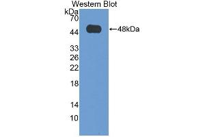 Western blot analysis of the recombinant protein. (VPS37A 抗体  (AA 1-397))
