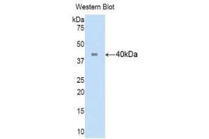 Western Blotting (WB) image for anti-Keratin 16 (KRT16) (AA 117-419) antibody (Biotin) (ABIN1172995)