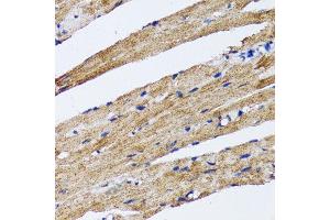 Immunohistochemistry of paraffin-embedded rat heart using MAP1LC3B antibody. (LC3B 抗体)