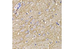 Immunohistochemistry of paraffin-embedded mouse brain using KCND3 antibody at dilution of 1:100 (x400 lens). (KCND3 抗体)