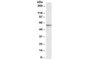 Western blot testing of K562 nuclear lysate with VRK2 antibody at 2ug/ml. (VRK2 抗体)
