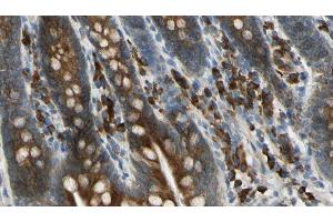 ABIN6276019 at 1/100 staining Mouse intestine tissue by IHC-P. (GPR158 抗体  (N-Term))