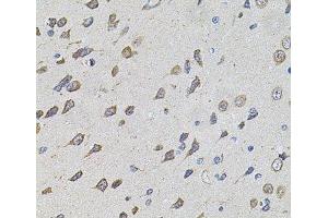 Immunohistochemistry of paraffin-embedded Rat brain using FoxO3a Polyclonal Antibody at dilution of 1:100 (40x lens). (FOXO3 抗体)
