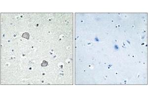 Immunohistochemistry analysis of paraffin-embedded human brain tissue, using EDG2 Antibody. (BUD31 抗体  (AA 5-54))
