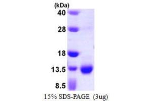 SDS-PAGE (SDS) image for S100 Calcium Binding Protein A3 (S100A3) (AA 1-101) protein (His tag) (ABIN667463) (S100A3 Protein (AA 1-101) (His tag))