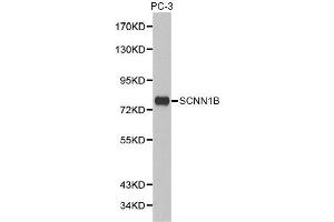 Western blot analysis of extracts of PC-3 cell lines, using SCNN1B antibody. (SCNN1B 抗体  (AA 406-640))