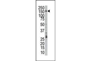 PRPF4B 抗体  (C-Term)