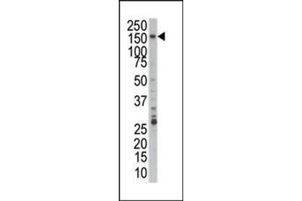 PRPF4B 抗体  (C-Term)