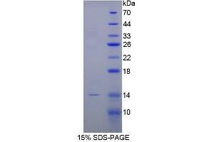 SDS-PAGE analysis of Rabbit BMP2 Protein. (BMP2 蛋白)