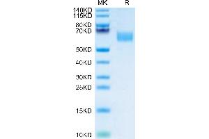 Mouse CD47 on Tris-Bis PAGE under reduced condition. (CD47 Protein (CD47) (AA 19-140) (Fc Tag))
