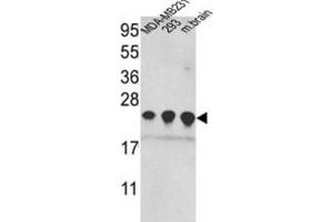 Western Blotting (WB) image for anti-Peroxiredoxin 2 (PRDX2) antibody (ABIN3001720) (Peroxiredoxin 2 抗体)