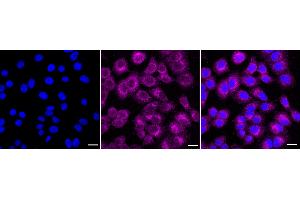 Immunocytochemical staining of HepG2 cells with Protein kinase N2 antibody (ABIN7800006), 1:1,000). (Recombinant PKN2 抗体)