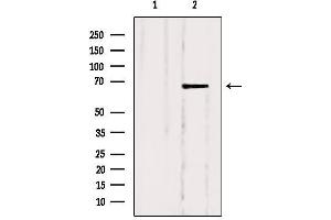Western blot analysis of extracts from Hela, using SLC5A6 Antibody. (SLC5A6 抗体  (C-Term))