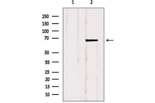 SLC5A6 antibody  (C-Term)