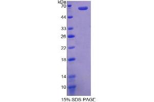 SDS-PAGE analysis of Mouse GMNN Protein. (Geminin 蛋白)