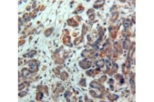 Used in DAB staining on fromalin fixed paraffin-embedded Pancreas tissue (NPTX2 抗体)