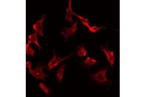 Immunofluorescence (fixed cells) (IF/ICC) image for anti-Protein Kinase, CAMP-Dependent, Regulatory, Type II, beta (PRKAR2B) (Internal Region) antibody (ABIN6264424)