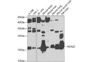 Western blot analysis of extracts of various cell lines, using NCALD antibody (ABIN6132891, ABIN6144390, ABIN6144391 and ABIN6224019) at 1:1000 dilution. (NCALD 抗体  (AA 1-193))
