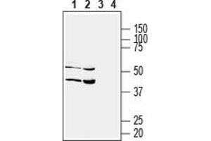 Western blot analysis of human HT-29 colorectal adenocarcinoma (lanes 1 and 3) and human HepG2 liver hepatome (lanes 2 and 4) cell lysates: - 1,2. (Solute Carrier Family 17 (Acidic Sugar Transporter), Member 5 (SLC17A5) (AA 479-492), (C-Term), (Intracellular) 抗体)