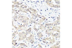 Immunohistochemistry (Paraffin-embedded Sections) (IHC (p)) image for anti-Yes-Associated Protein 1 (YAP1) antibody (ABIN1683302)