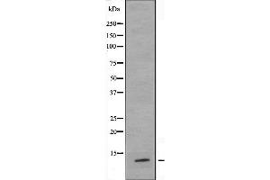 Western blot analysis of extracts from COLO cells, using RPL36 antibody. (RPL36 抗体  (C-Term))