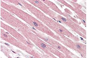 Human Heart (formalin-fixed, paraffin-embedded) stained with CASP1 antibody ABIN461892 at 5 ug/ml followed by biotinylated goat anti-rabbit IgG secondary antibody ABIN481713, alkaline phosphatase-streptavidin and chromogen. (Caspase 1 抗体)