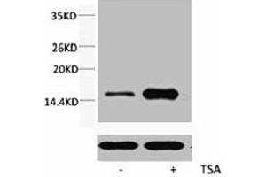 Western blot analysis of extracts from Hela cells, untreated (-) or treated, 1:2000. (HIST1H3A/HIST2H3A/H3F3A (H3K56ac) 抗体)