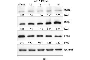 Western Blotting (WB) image for anti-Superoxide Dismutase 1, Soluble (SOD1) (C-Term) antibody (ABIN2854826)