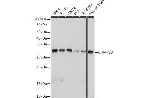 Western blot analysis of extracts of various cell lines, using CHMP2B antibody (ABIN7266290) at 1:1000 dilution. (CHMP2B 抗体)