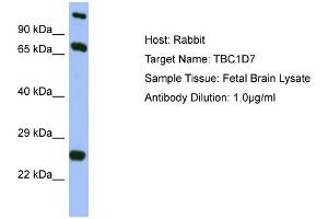 Host: Rabbit Target Name: TBC1D7 Sample Type: Fetal Brain lysates Antibody Dilution: 1. (TBC1D7 抗体  (Middle Region))