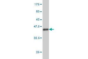Western Blot detection against Immunogen (37.