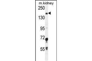 Western blot analysis in mouse kidney tissue lysates (35ug/lane). (IGSF1 抗体  (C-Term))