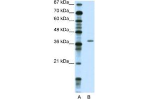 Western Blotting (WB) image for anti-Zinc Finger Protein 444 (ZNF444) antibody (ABIN2461893) (ZNF444 抗体)